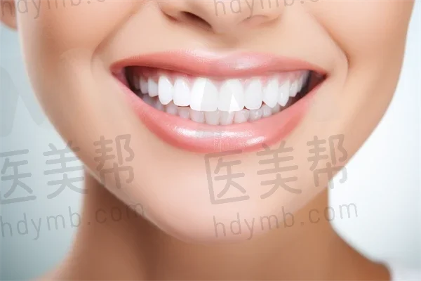 银川瑞德口腔诊所牙套现价仅需3999元起，原价5000元起，助您轻松实现良好笑容，优惠活动火热进行中！