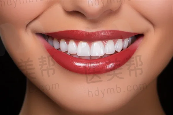 杭州罗强口腔(宝龙门诊部)牙齿修复现价3000元起，优惠活动仅需2500元起！