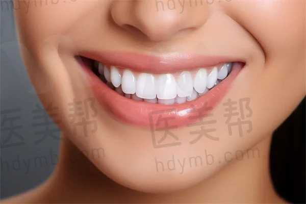 深圳德贝美景龙口腔门诊部口碑评价高吗？答案是口碑评价真的很不错，服务贴心又专業！