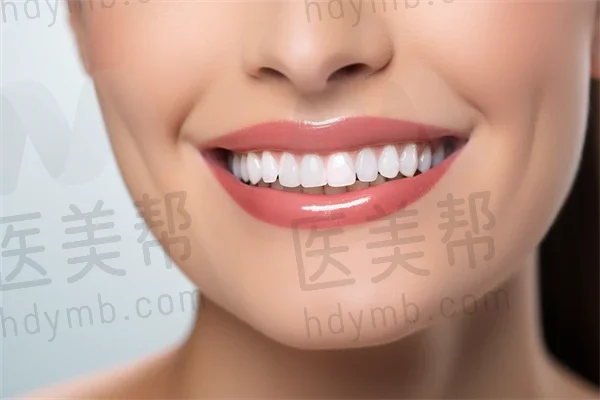 嘉兴笑更美口腔门诊部洗牙收费仅需198元起，原价298元起，限时优惠，优异机会！