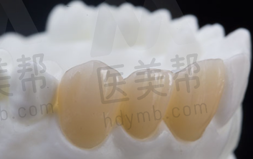 牙齿矫正价格表