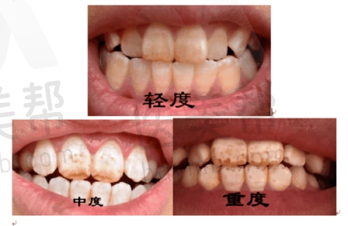 文章结尾总结