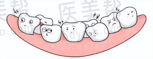 看牙优势之价格实惠