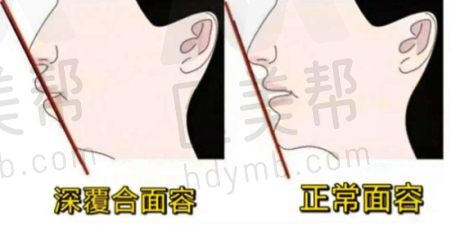 种植牙医生推荐