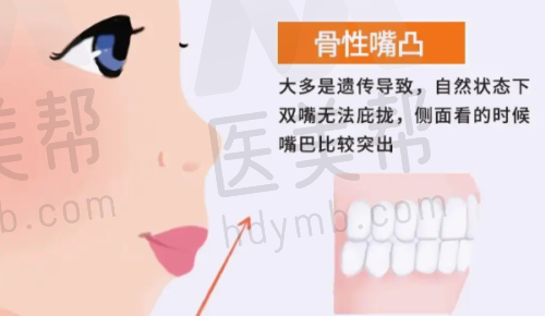 种植牙优势