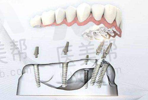 特色优势:全方面保护口腔健康