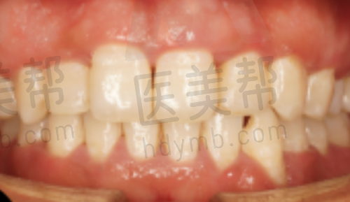 疫情防控措施:保护患者安心看牙