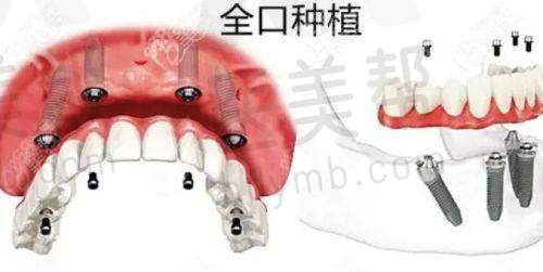 梅州市中大口腔门诊靠谱性体现在哪