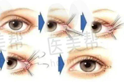北京卓艺医疗美容诊所的口碑与可靠性分析