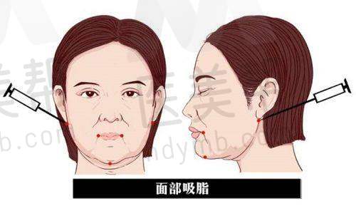 新乡仁爱妇产医院科室与设备靠谱吗