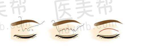 合肥高新区汇美丛生医疗美容诊所的情况推测