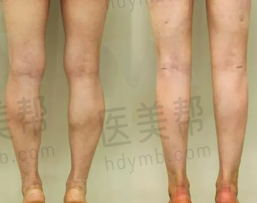 医美行业的发展趋势与消费者选择