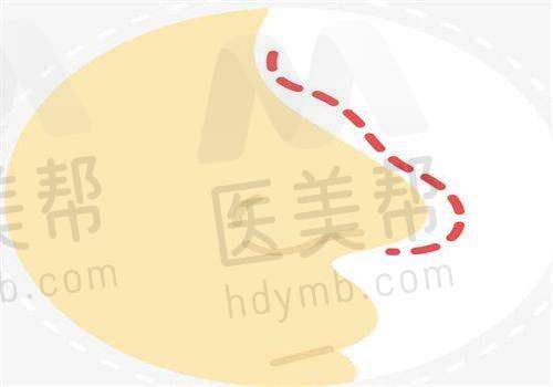 长沙熙朵医疗美容诊所业务范围靠谱吗
