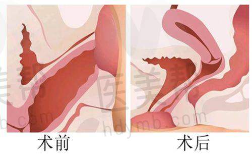 新乡仁爱妇产医院患者评价如何