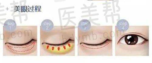 上饶童晓玮医疗美容诊所医院优势靠谱吗