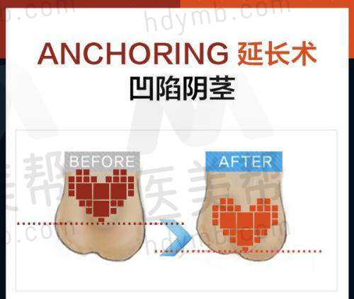 设备良好硬件保护