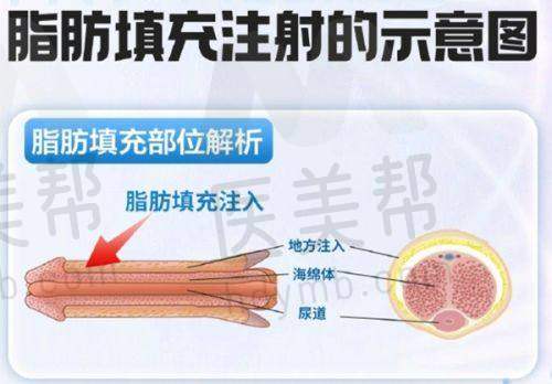 眼部整形:个性化塑造美眸