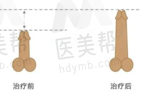 红旗东方美医疗美容诊所植发靠谱性分析