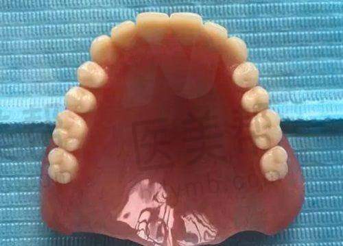 总结