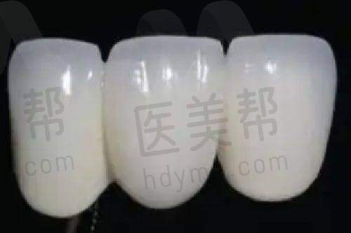 牙齿矫正价格