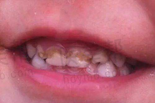 患者实例分享
