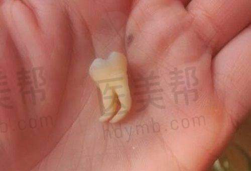 佳美口腔高价服务包含哪些项目