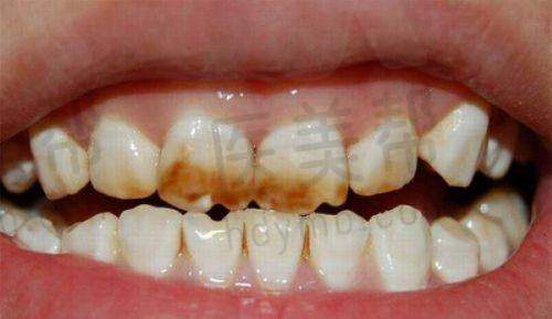 与其他正规口腔医疗机构的对比