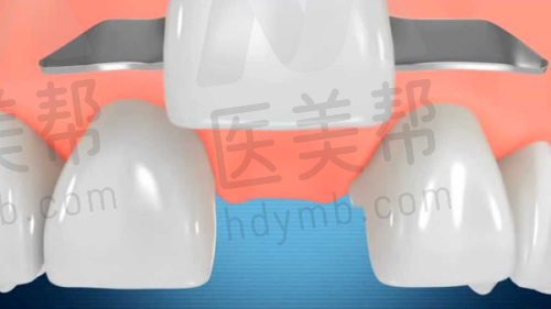 上饶口腔医院的收费标准