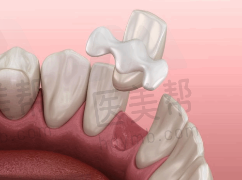 北京劲松口腔医院口碑与其他口腔医院对比