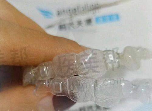 选择武汉牙科医院的建议