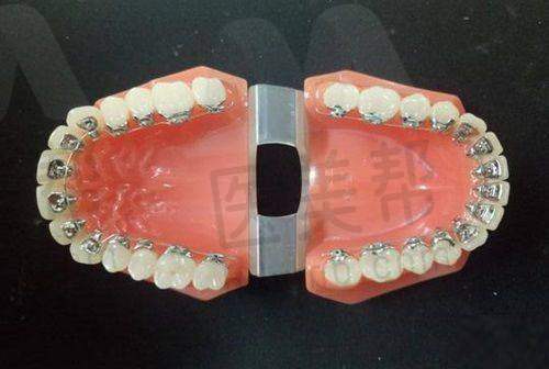 黔西金铂士口腔门诊部的服务项目有哪些