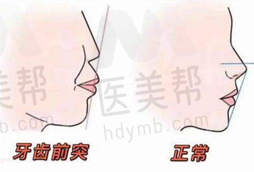 可开展的口腔大项目