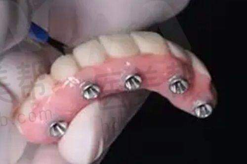 技术优势