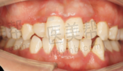 个性化、稳准化的口腔医疗服务