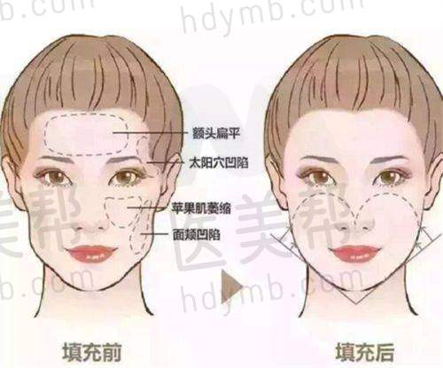 选择缩胸医院的注意事项