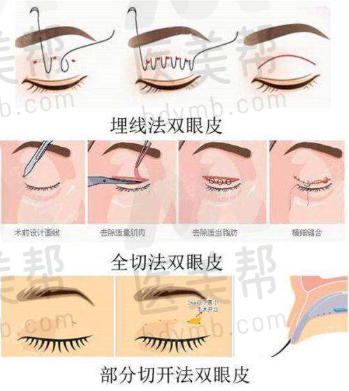 其他项目:满足多样需求