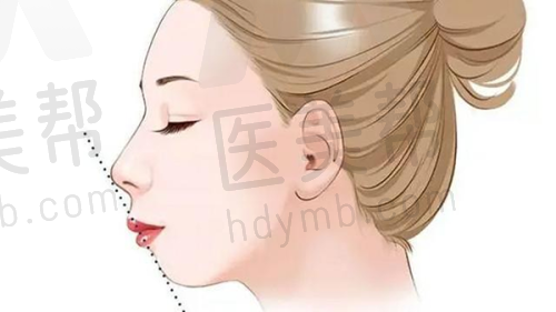 口碑评价
