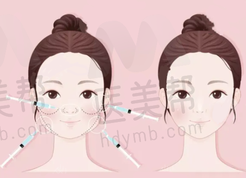 隆胸收费规范