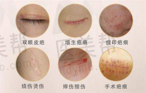 术后注意事项