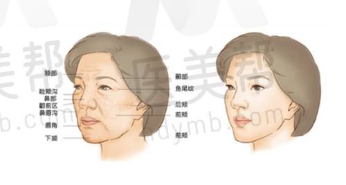 新乡地区整形项目价格参考