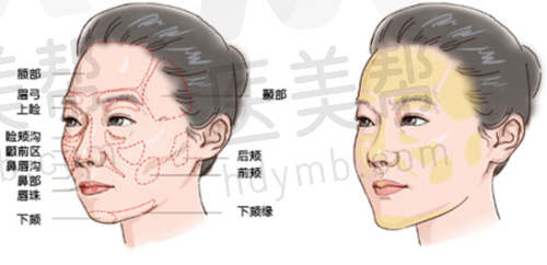 与其他机构对比(以肋骨隆鼻为例)
