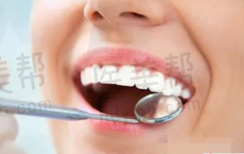 广州柏德口腔门诊部（越秀院区）特色项目