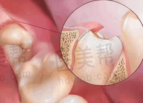 口腔项目参考价格