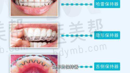 正畸优势
