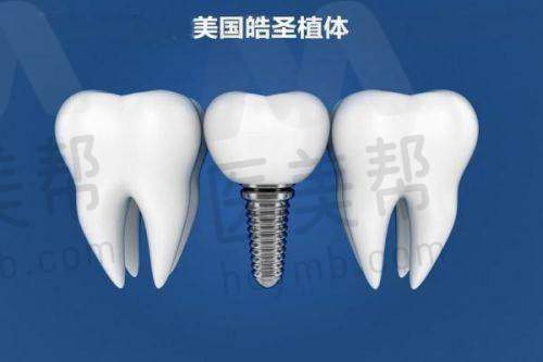 一个牙医良心忠告对正畸人群的注意事项