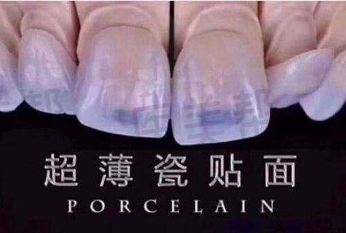 成都团圆口腔门诊部收费价格贵不贵