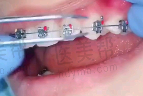 广州柏德口腔门诊部（越秀院区）医生介绍