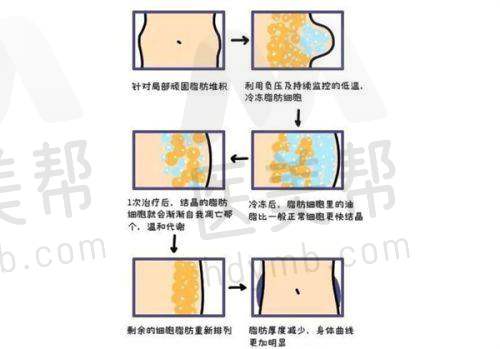 影响维持时间的因素 - 日常护理