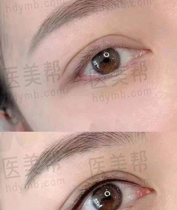 如何在福州选择性价比高的嘴巴整形机构